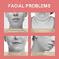 Facial Slimming V Shape Line Lifting Chin Strap - FelinWel